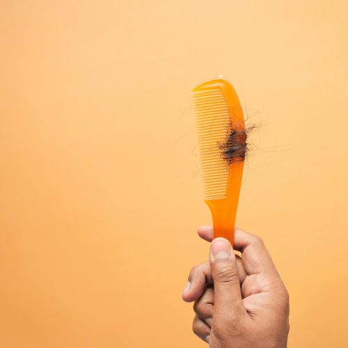 Queda de Cabelo: Causas e Tratamentos